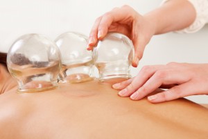 Detail of an acupuncture therapist removing a glass globe in a fire cupping procedure Fotolia_36496377